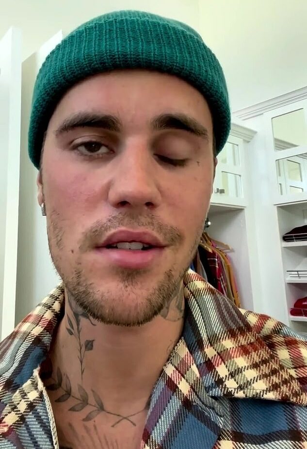 Justin Bieber Reveals He Has Facial Paralysis From Ramsay Hunt Syndrome