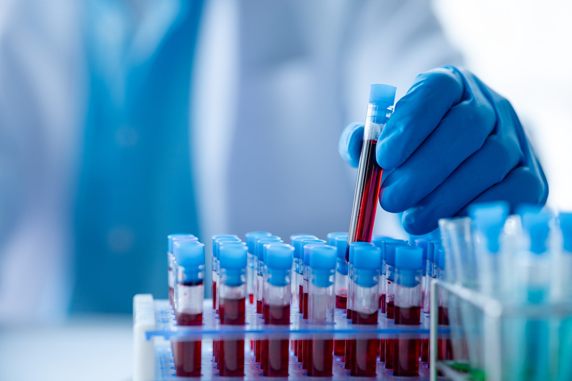 new-blood-tests-for-dementia-announced-but-what-can-they-tell-us-and