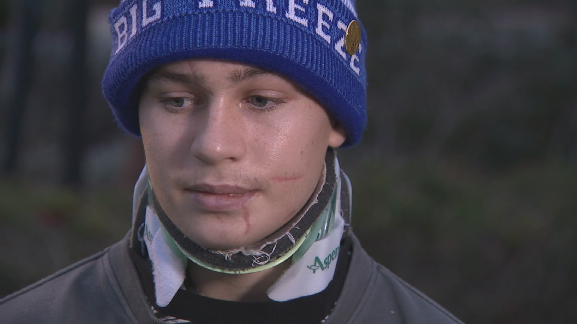 One dead, one charged, one out of coma after horror 18th birthday crash