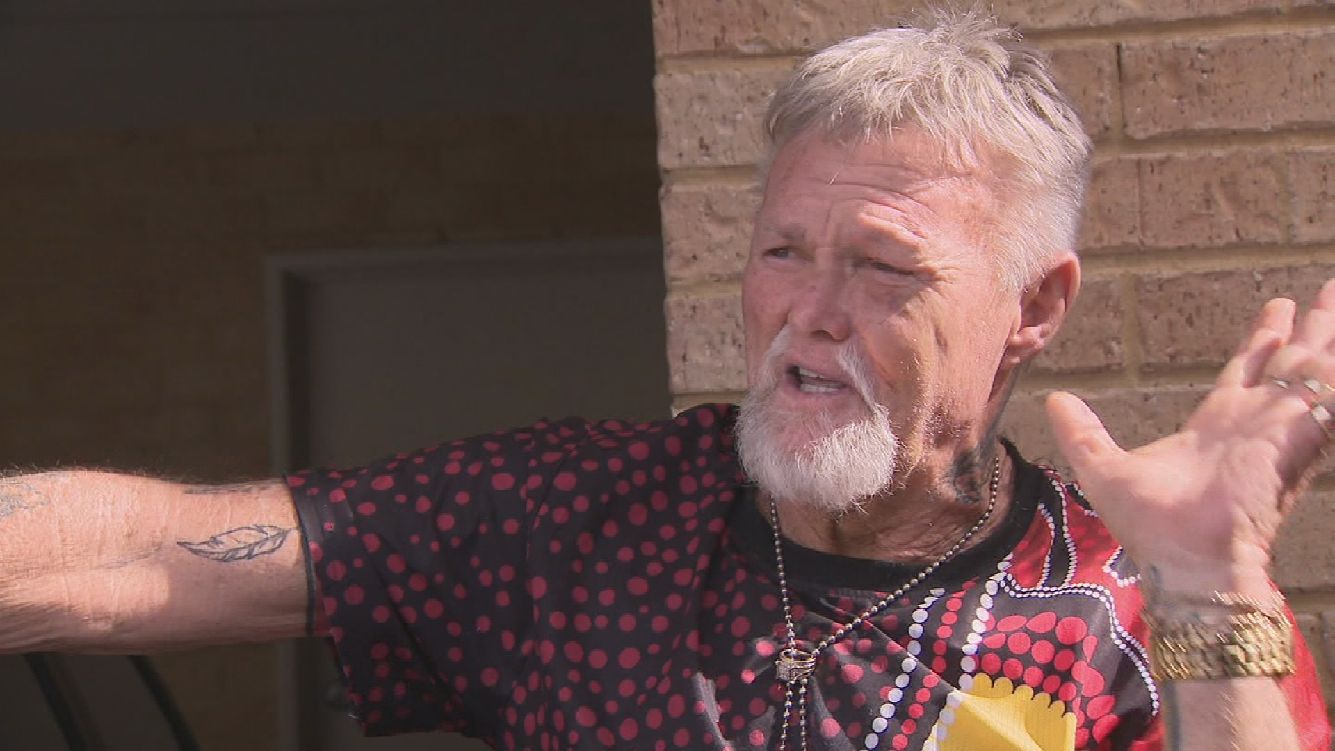 ‘They had to pull my cheek bone back out’