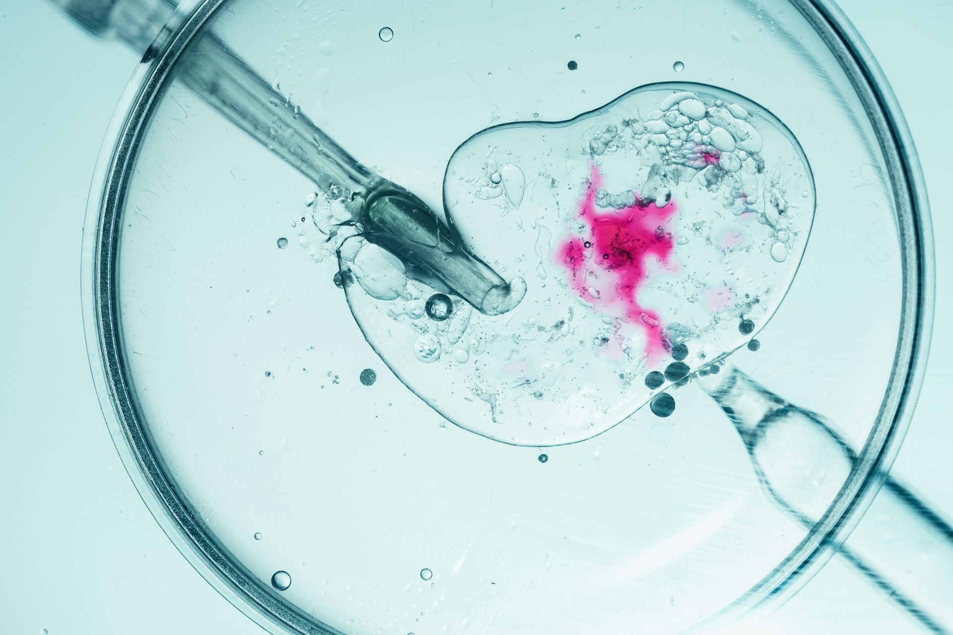 Weight loss support before IVF could boost pregnancy chances – and reduce the need for treatment